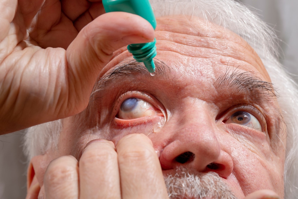 Kako liječiti glaukom?
